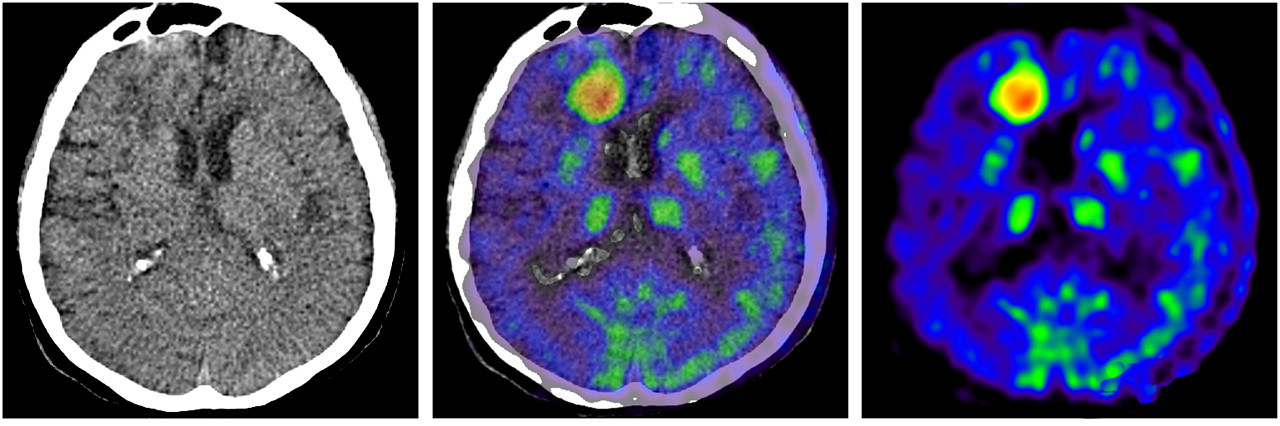 Advanced Radiology Consultants: PET/CT