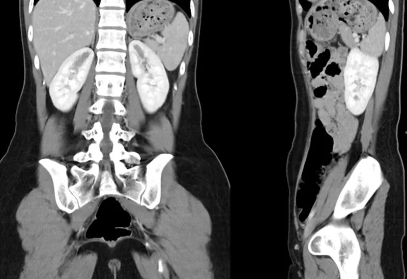 servicepg-hero-image-nuclear-medicine Nuclear Medicine